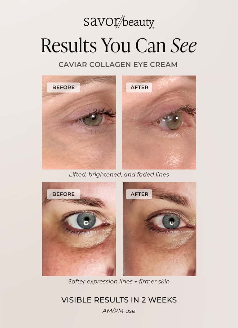 Before and after results showing Savor Beauty Caviar Collagen Eye Cream reducing fine lines and brightening eye area in 2 weeks