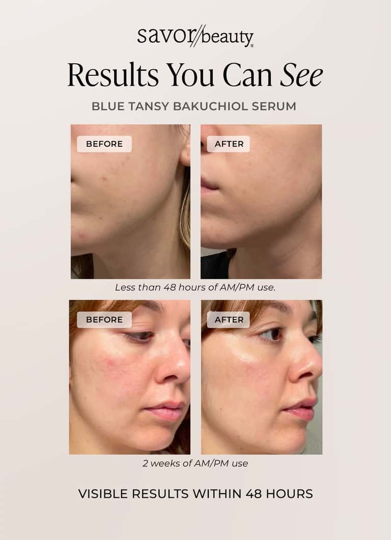 Before and after photos demonstrating Blue Tansy Bakuchiol Serum results with visible skin improvement within 48 hours