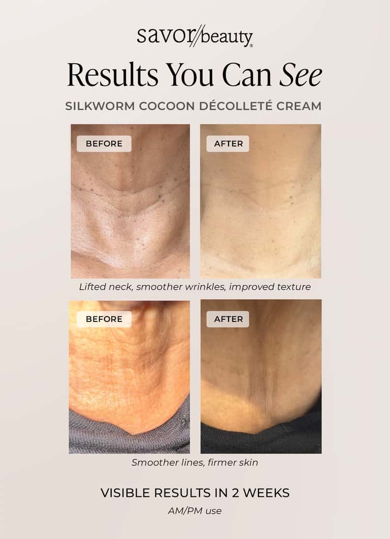 Before and after results of Silkworm Cocoon Décolleté Cream showing lifted neck and smoother skin