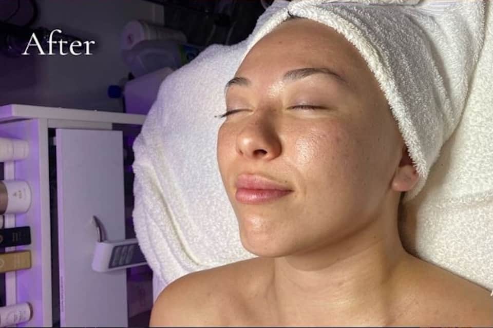 Woman's face after spa treatment, wearing white towel wrap, eyes closed, glowing skin