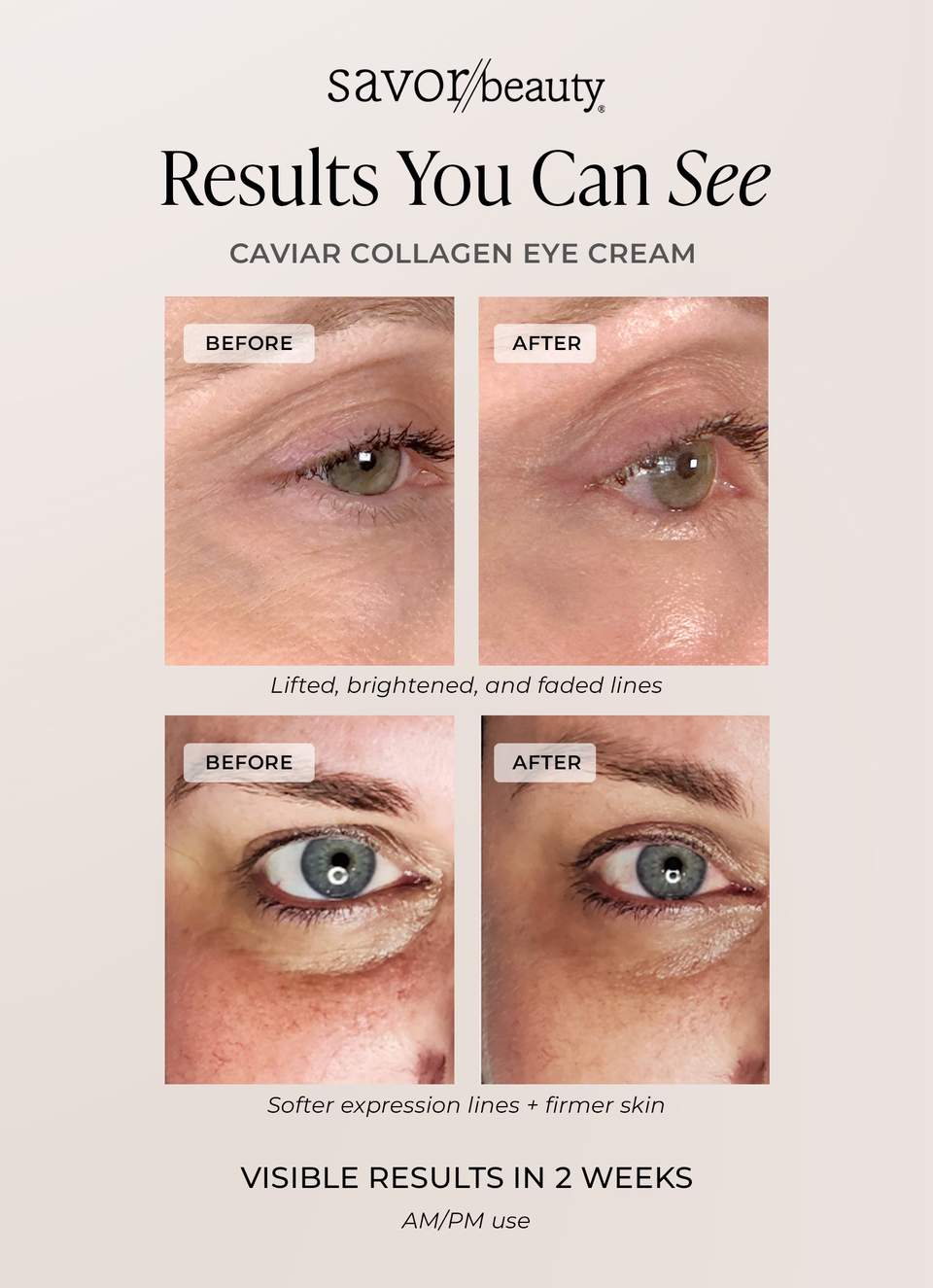 Before and after results showing Savor Beauty Caviar Collagen Eye Cream reducing fine lines and brightening eye area in 2 weeks