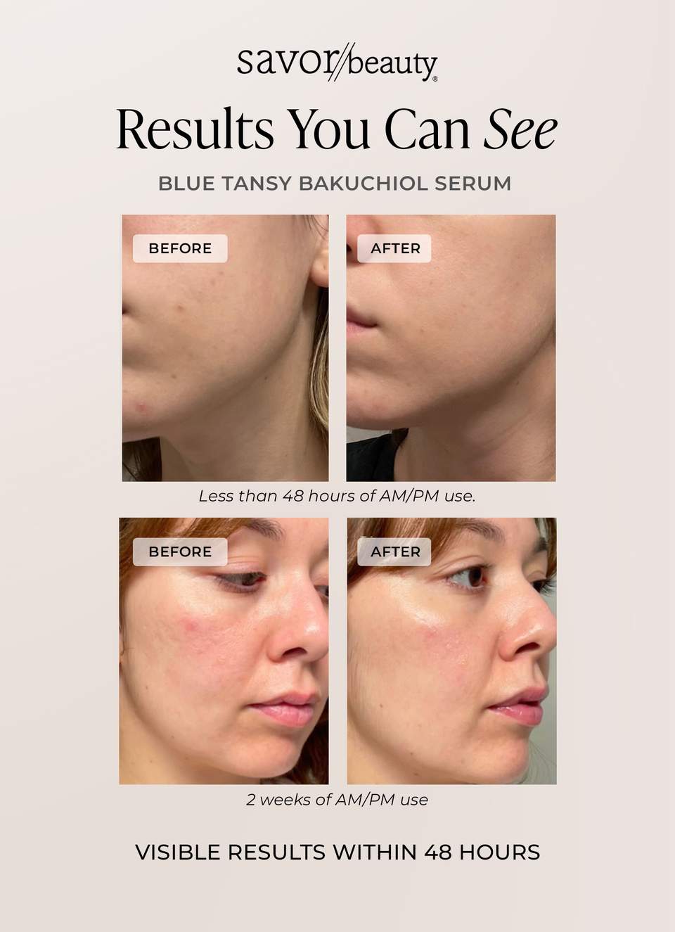 Before and after photos demonstrating Blue Tansy Bakuchiol Serum results with visible skin improvement within 48 hours