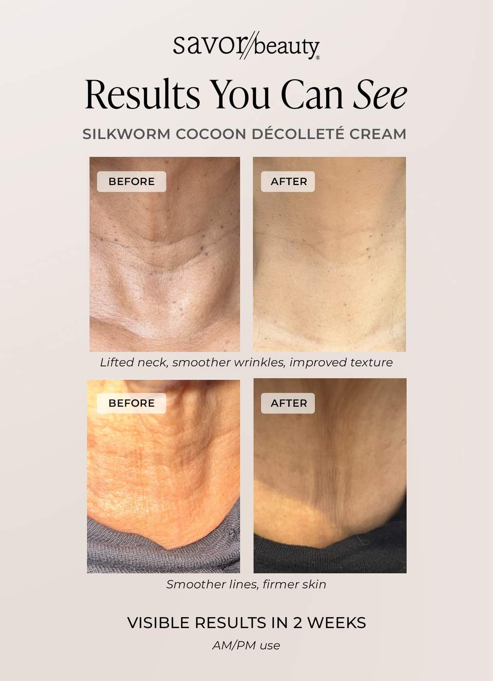 Before and after results of Silkworm Cocoon Décolleté Cream showing lifted neck and smoother skin