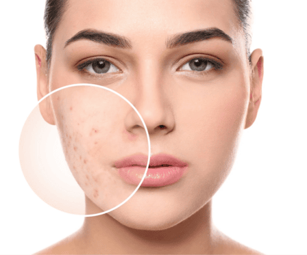 Radiant Refine Spa